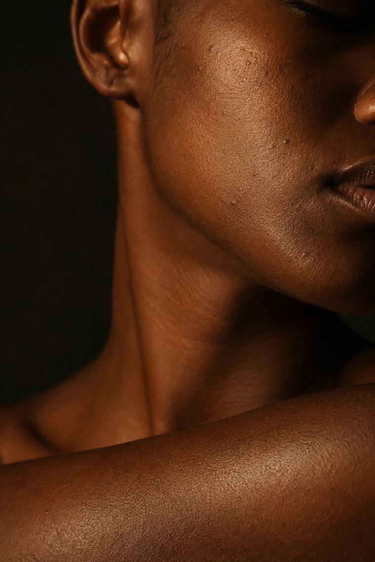 Close crop showing skin texture and pigment on a shoulder and neck